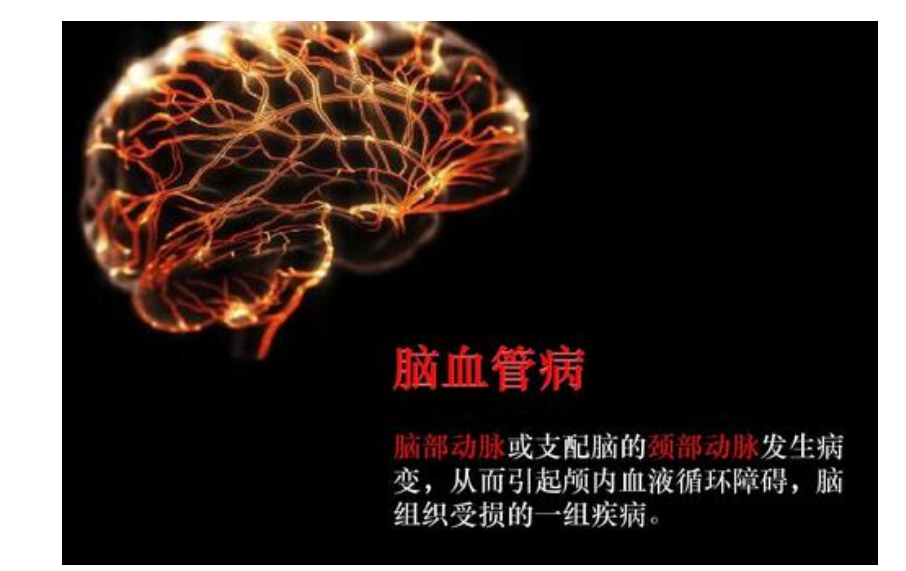 維生素D與神經(jīng)系統(tǒng)疾病相關性研究進展